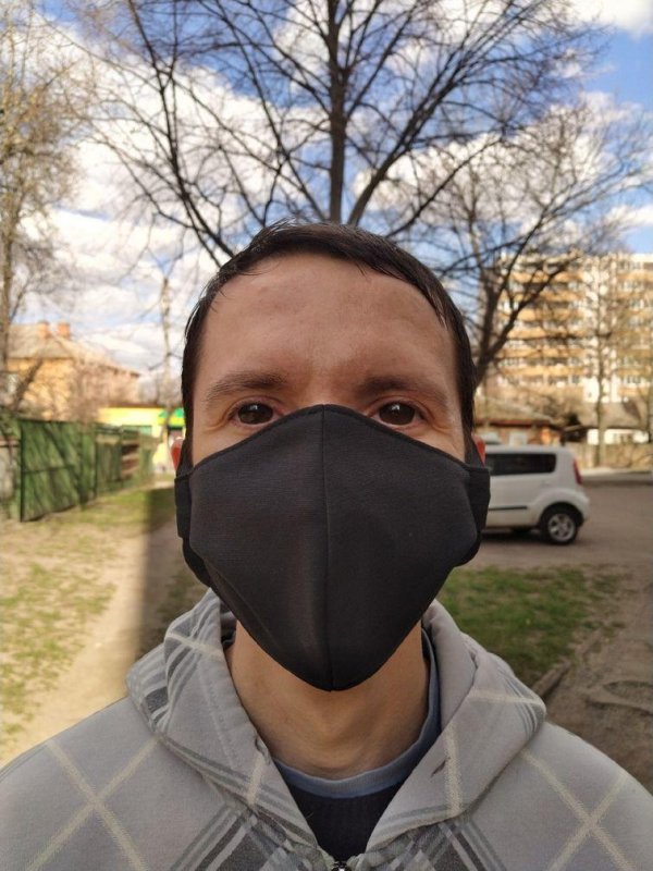 Врождённое увеличение роговицы, что делает глаза парня такими необычными