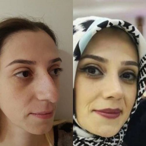 Фотография: Девушки до и после всего одного изменения во внешности №7 - BigPicture.ru