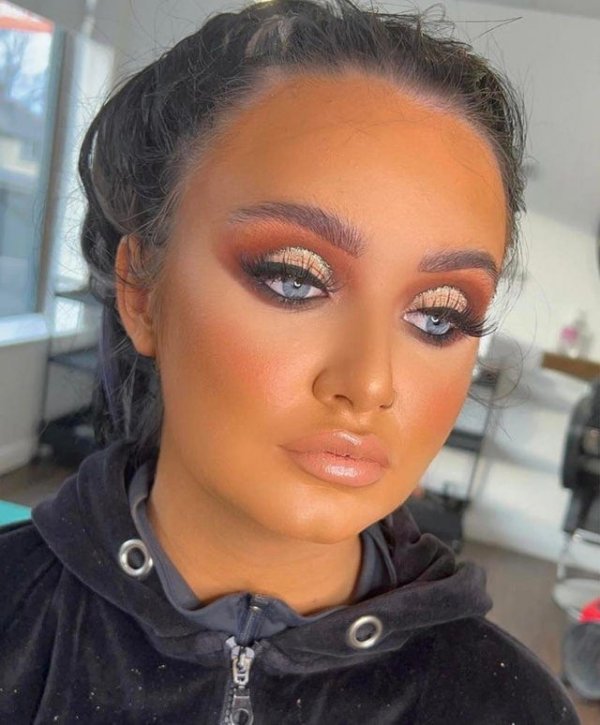 А тут возможно у девушки отказывает печень. Дело серьезное